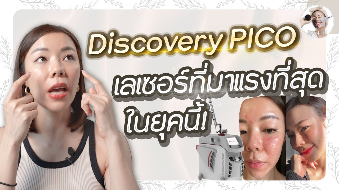 EP.93 : Discovery PICO เลเซอร์ที่มาแรงที่สุดในยุคนี้!