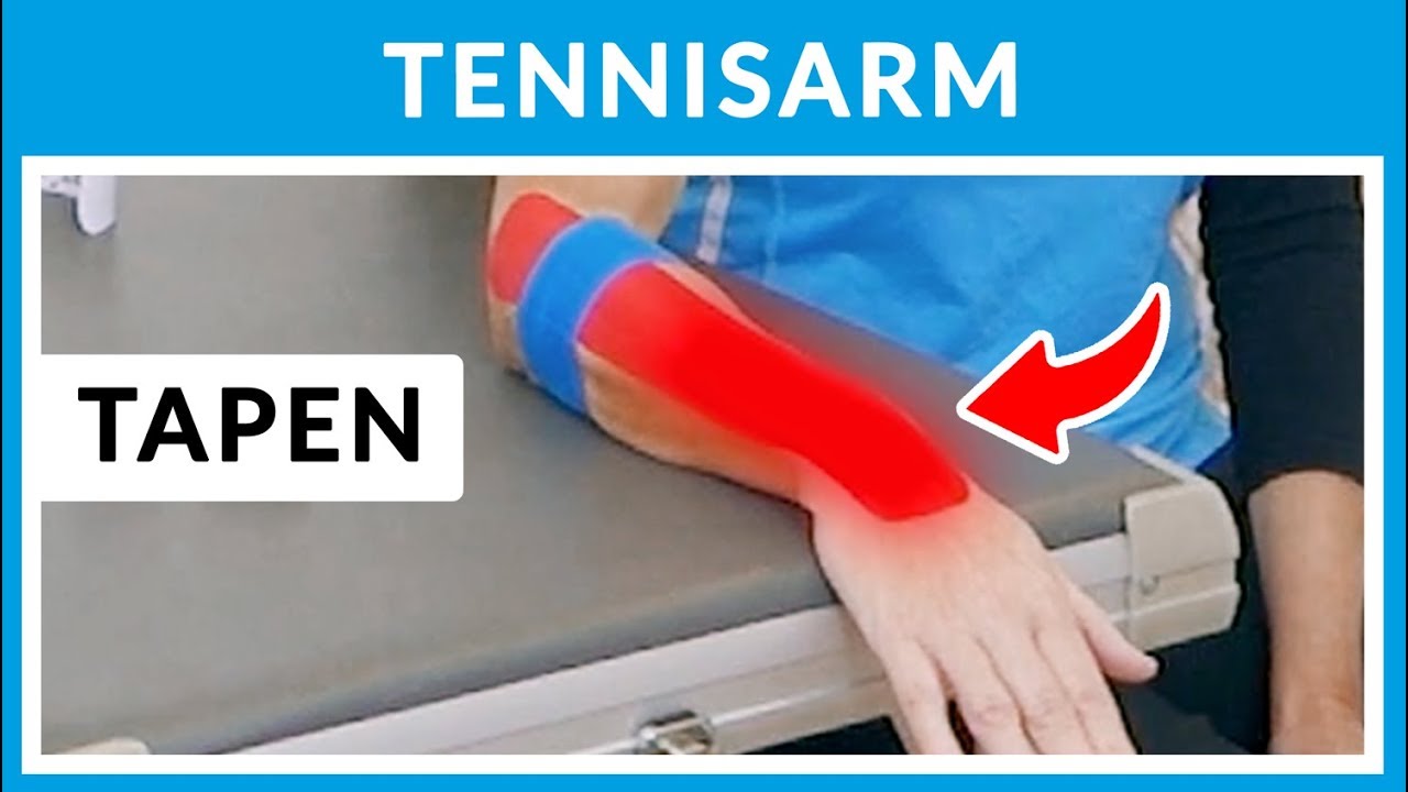Tennisellenbogen / Tennisarm Kinesio-Tape + Übungen (Teil 2)