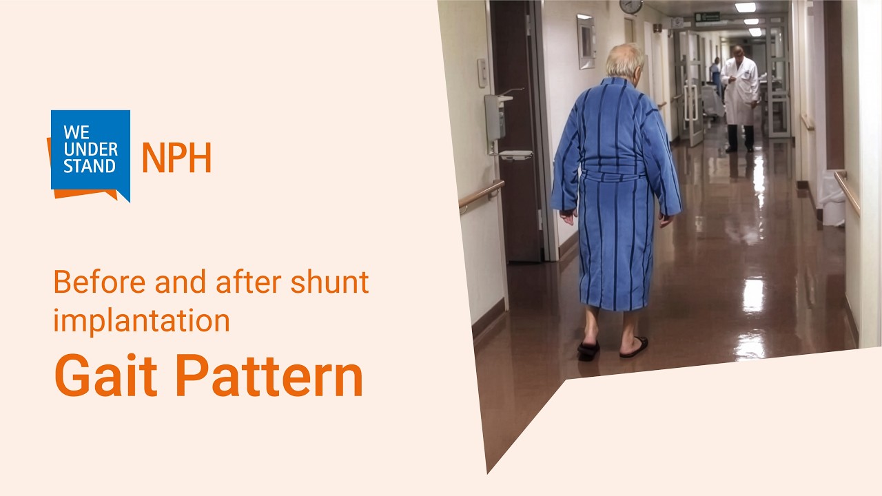 NPH treatment: gait pattern before and after shunt implantation