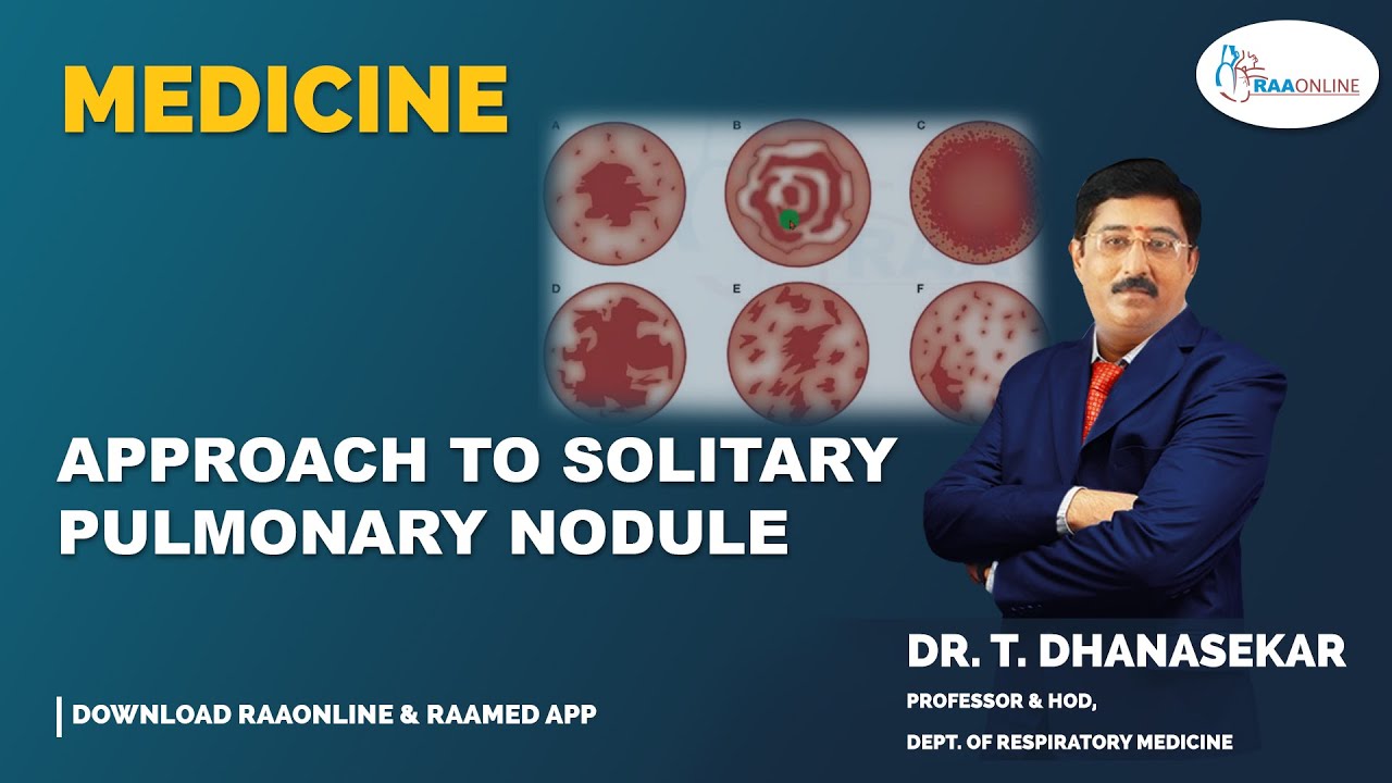 APPROACH TO SOLITARY PULMONARY NODULE