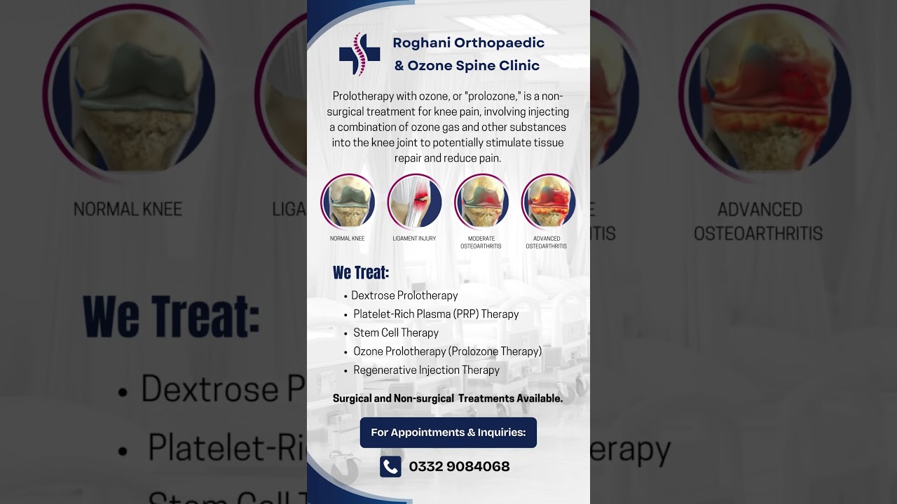 Prolotherapy with ozone, or 