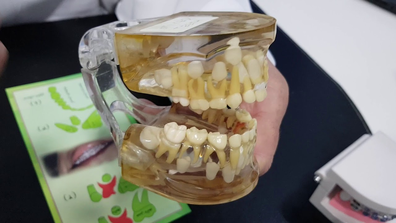 اهمية المتابعة  الدوريةلنمو الاسنان وصحتها .  Follw up of Dental Development & Health