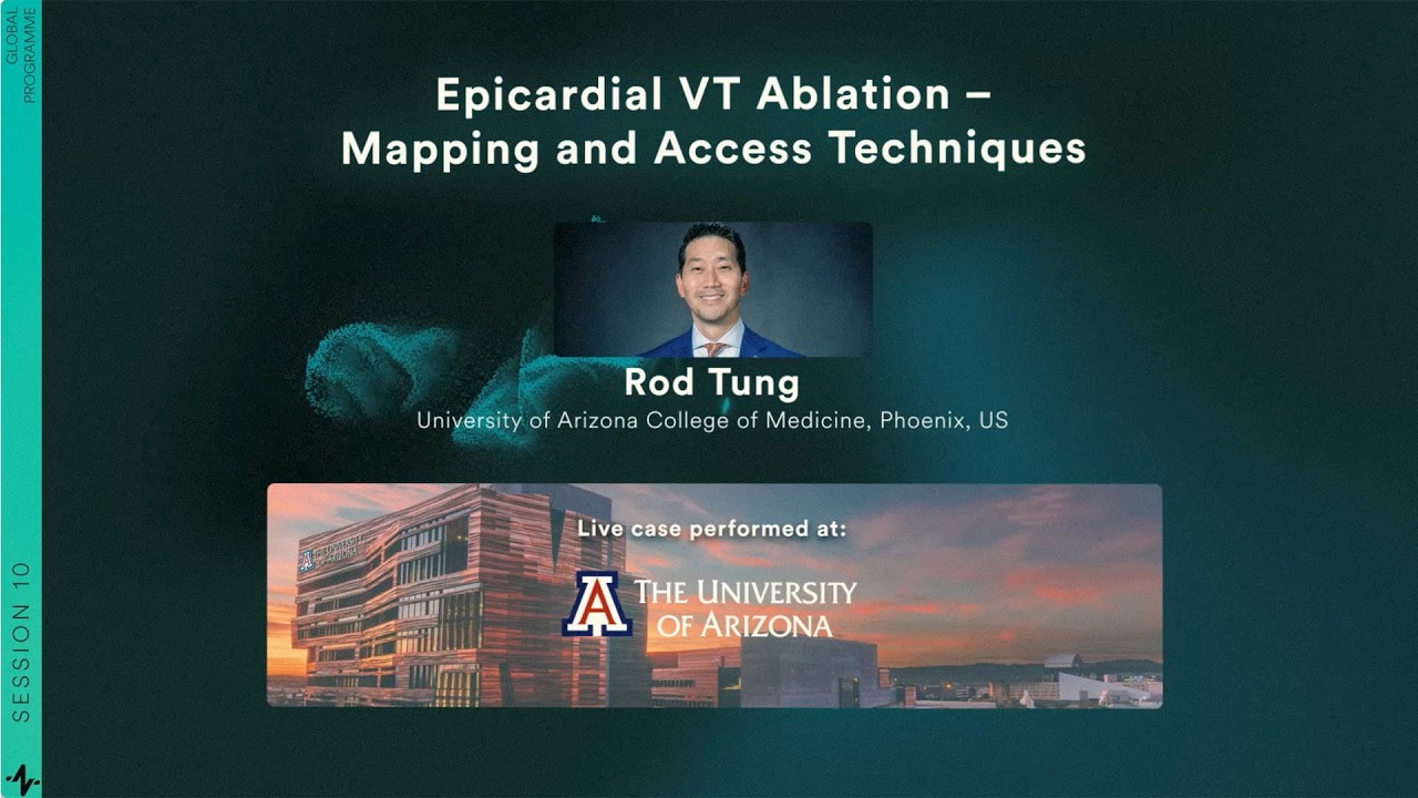 RIO 2025 | Live Case & Discussion: Epicardial VT Ablation – Mapping and Access Techniques