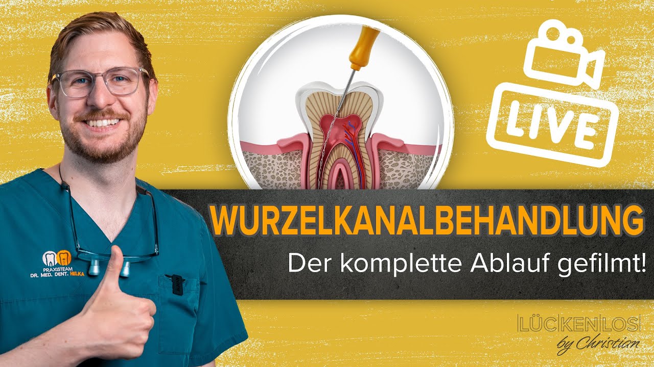 Wurzelkanalbehandlung am Modell - komplett gezeigt #L&uuml;ckenlos