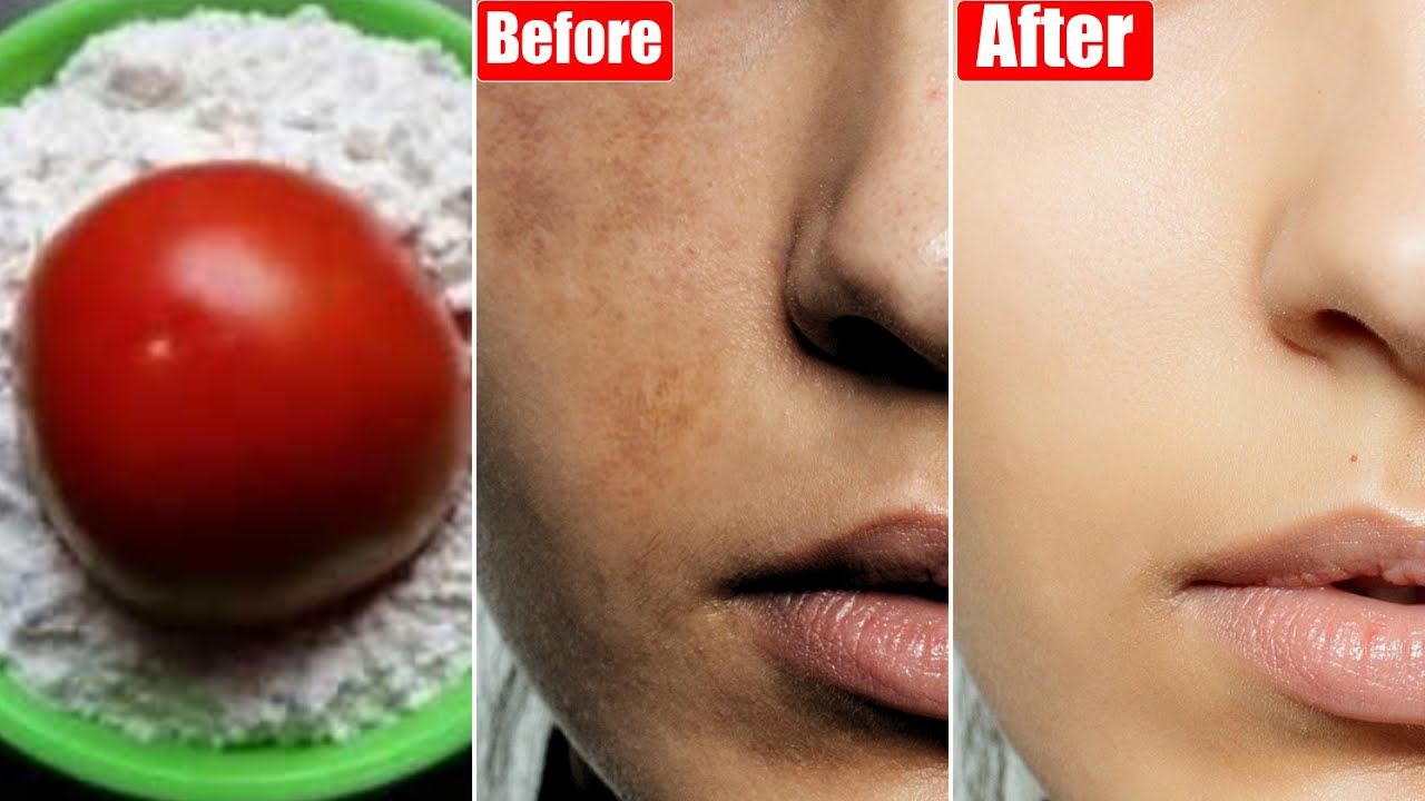 I rubbed this just 3 times & I was Shocked😱झाइयाँ Pigmentation Spots सब ख़त्म-Get Fair Skin Naturally