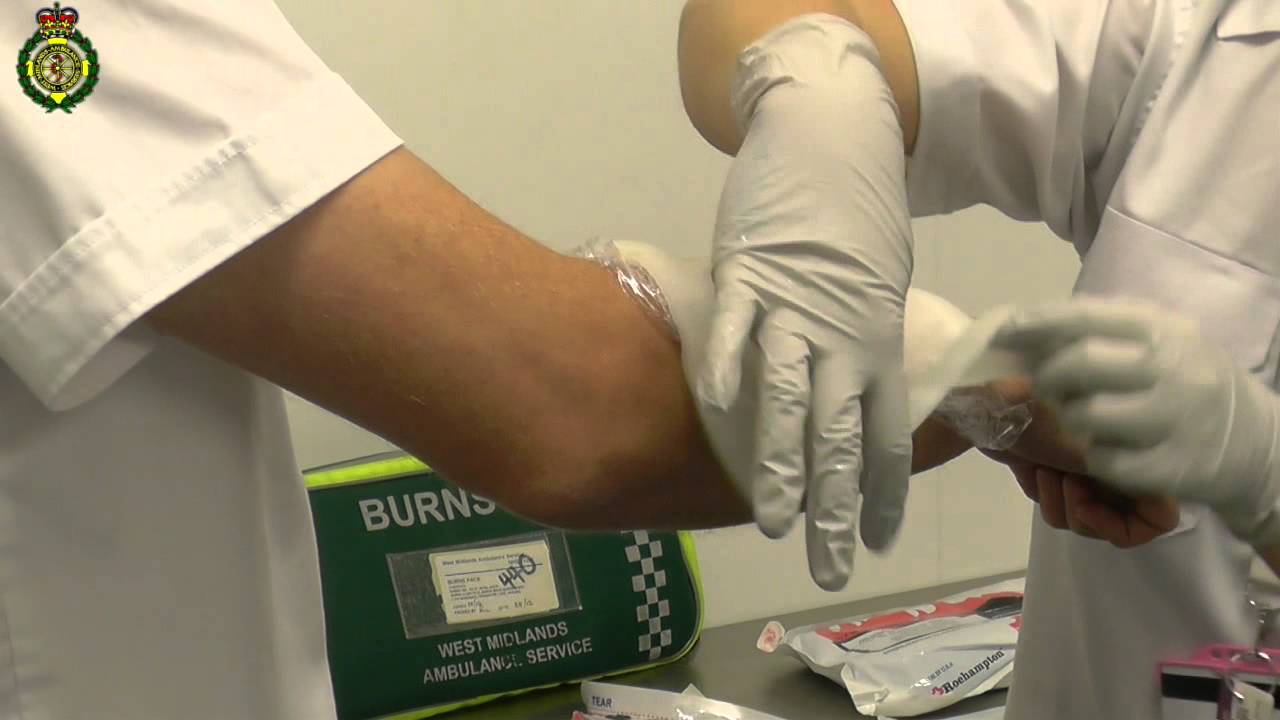 How to treat a burn