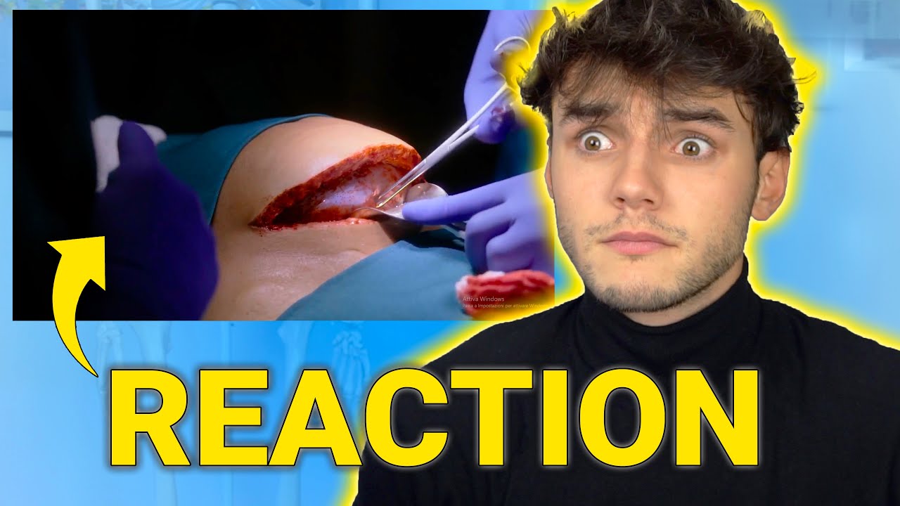 REACTION di uno Studente di MEDICINA a The Good Doctor | 1x4