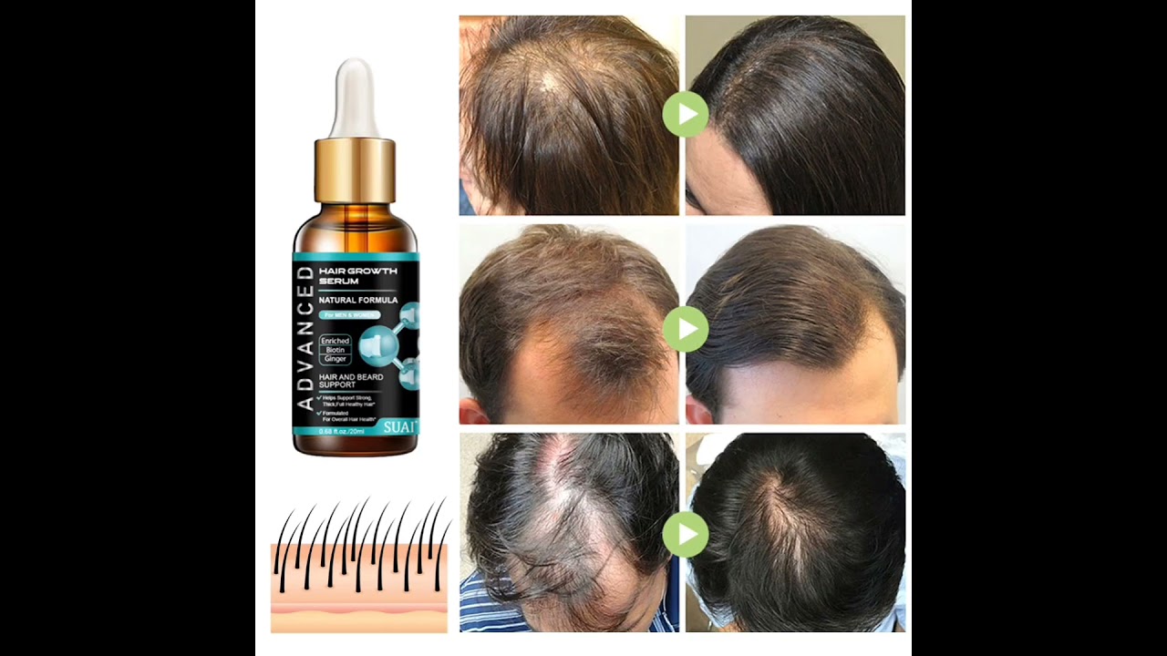 Ginger Hair Growth Oil💖Simple Beauty Care Store