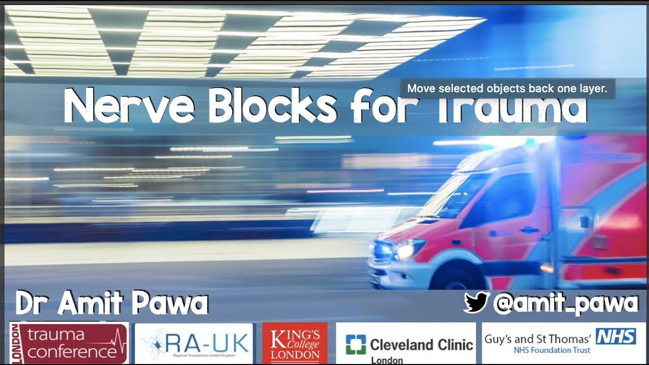 Nerve Blocks for Trauma - London Trauma Conference 2022 version