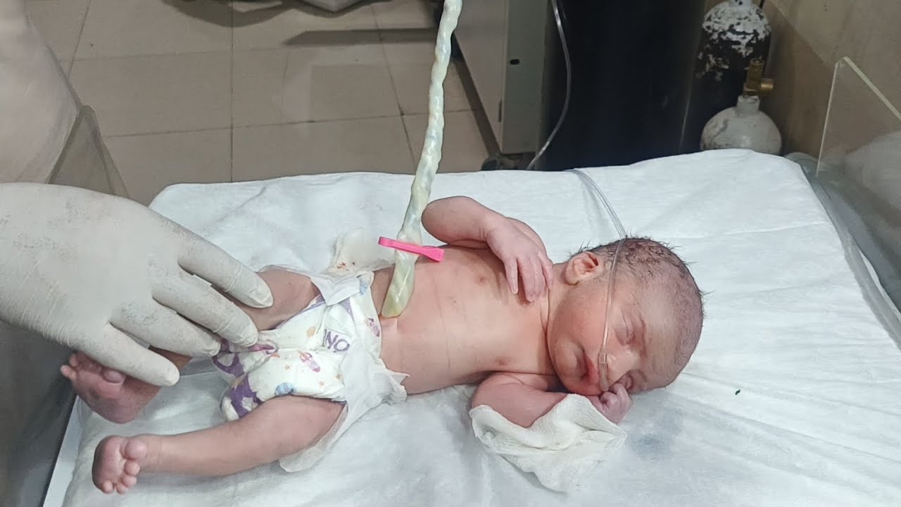 Newborn Baby Umbilical Cord Care & Length Measurement | Neonatal Assessment | NICU nurse Care