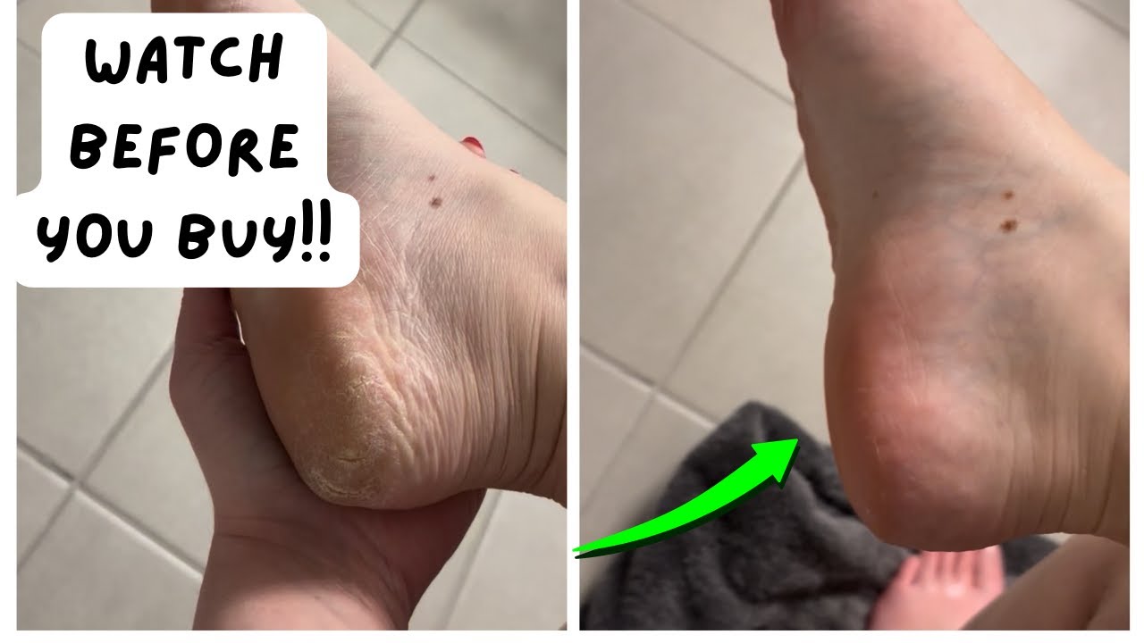 Honest Review - Rikans Foot Rasp