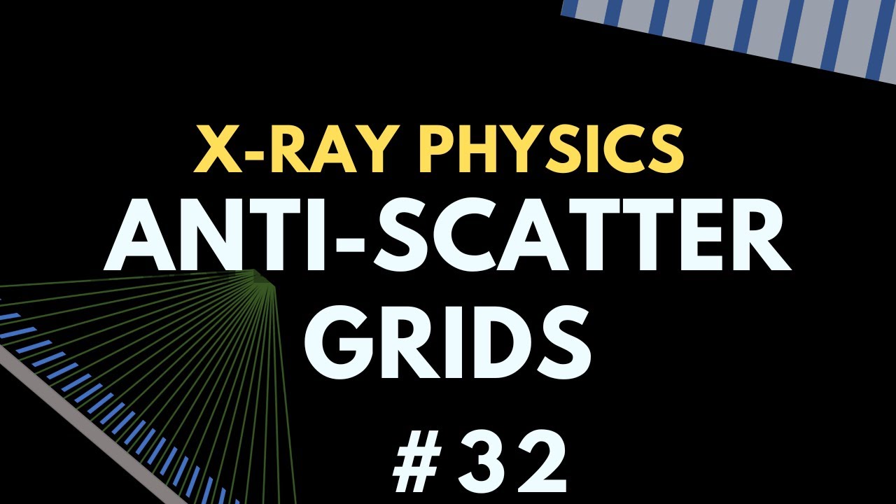 Anti-scatter grids | X-ray Physics | Radiology Physics Course #39