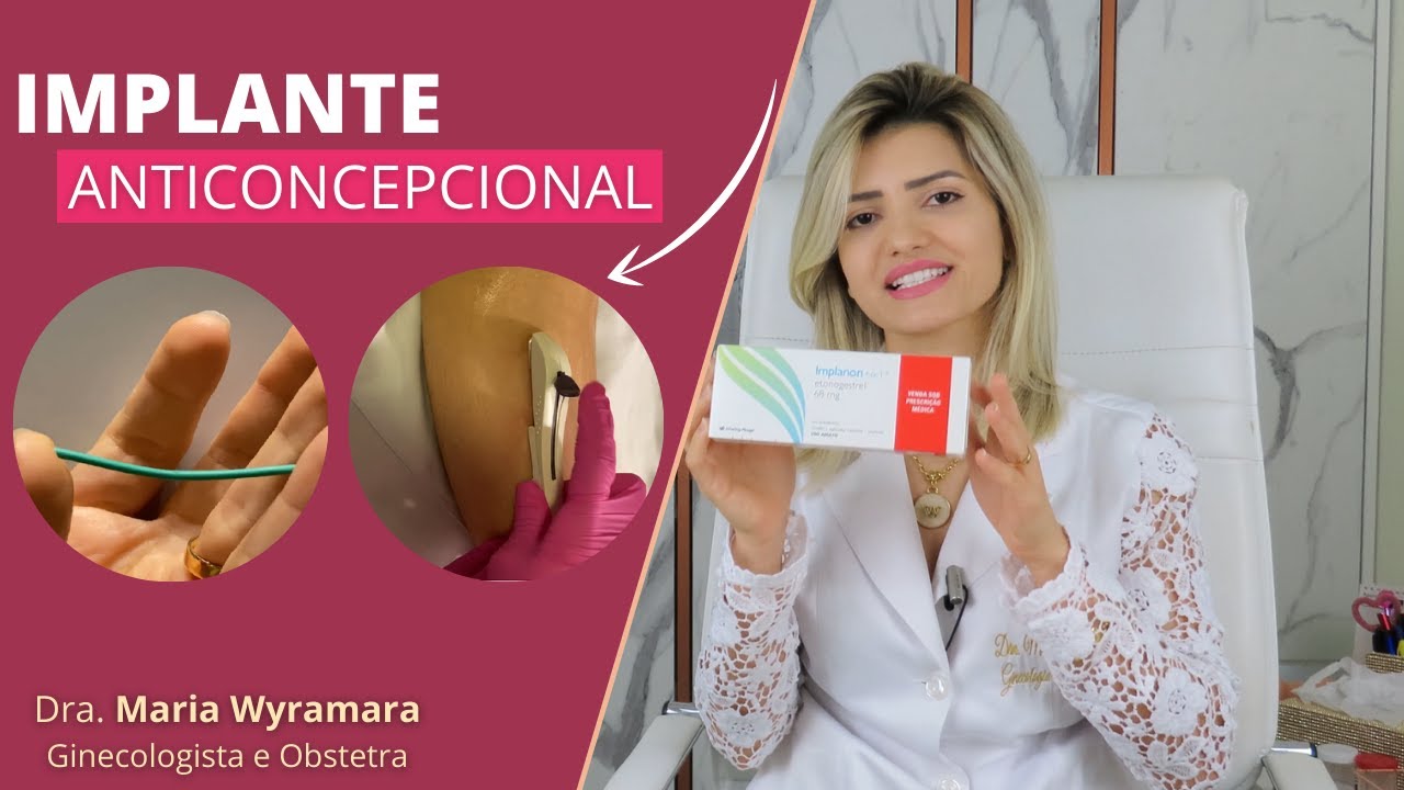 Implante Anticoncepcional | Vantagens e Efeitos Colaterais | IMPLANON |