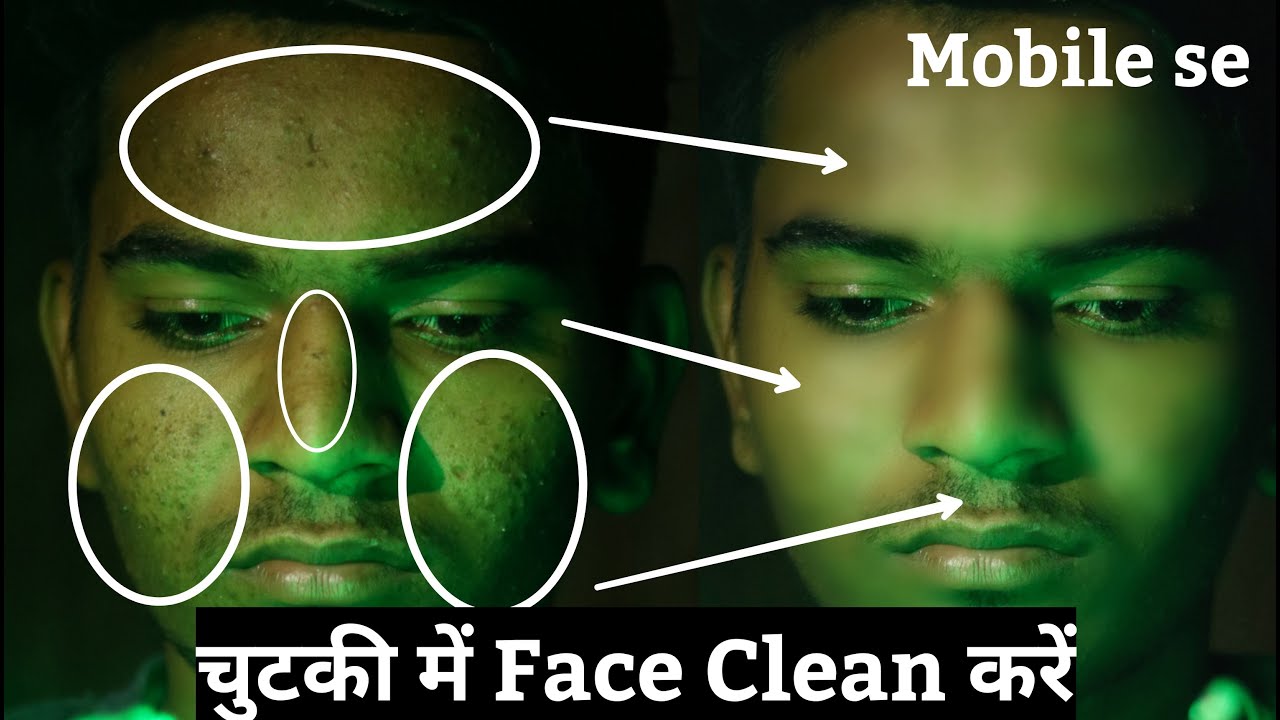 How to remove pimples & dark spots in photos in snapseed