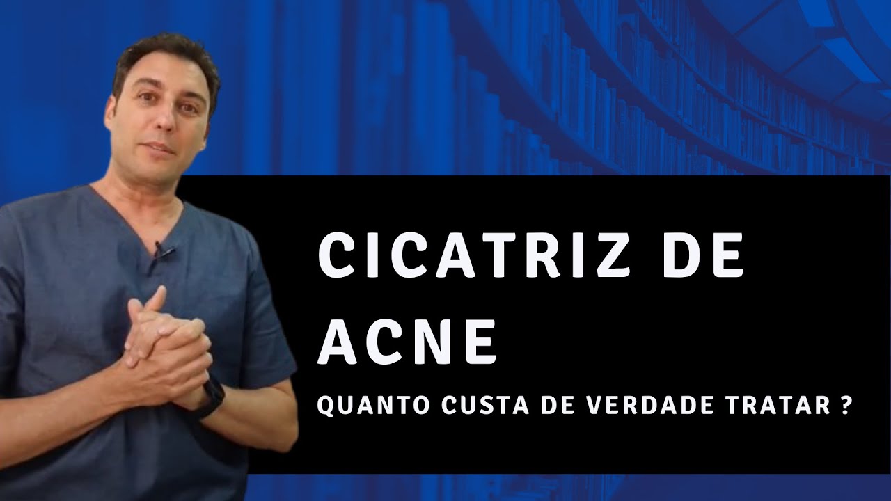 Quanto custa de verdade tratar a cicatriz de ACNE ?