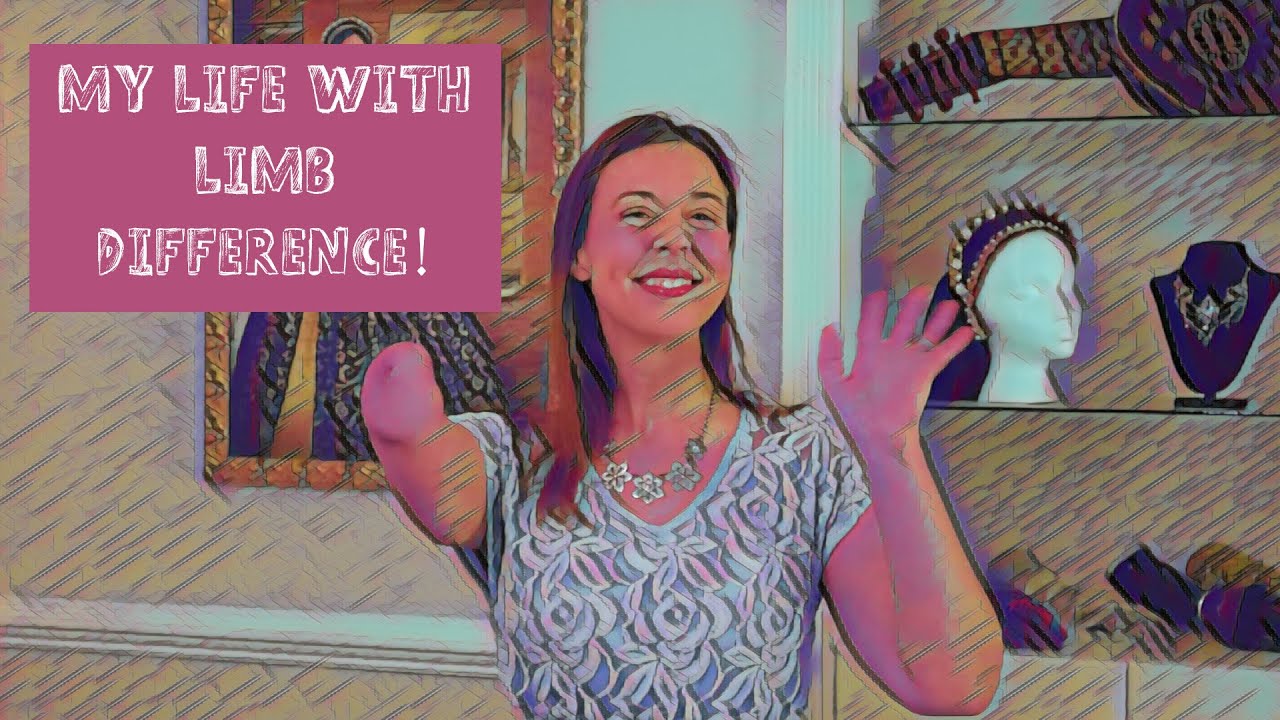 My Life with a Limb Difference!