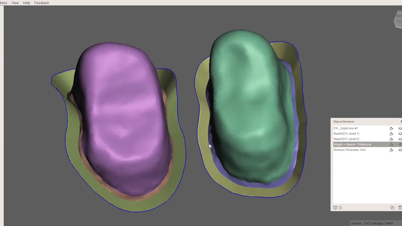 Meshmixer - Advanced Crown Design (Emergence Profile Technique)