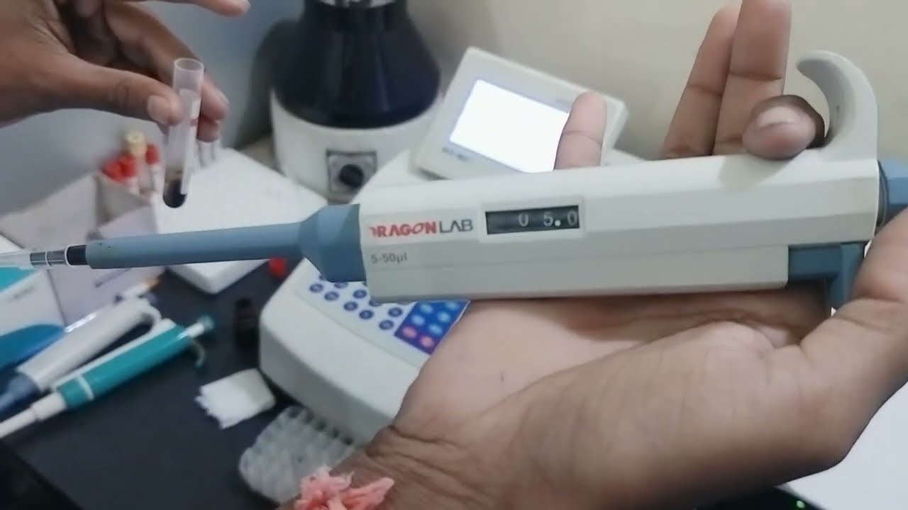 Rheumatoid Arthritis (RA FACTOR) Quantitative Test by Semi Auto Analyzer@PathologyExplorer77