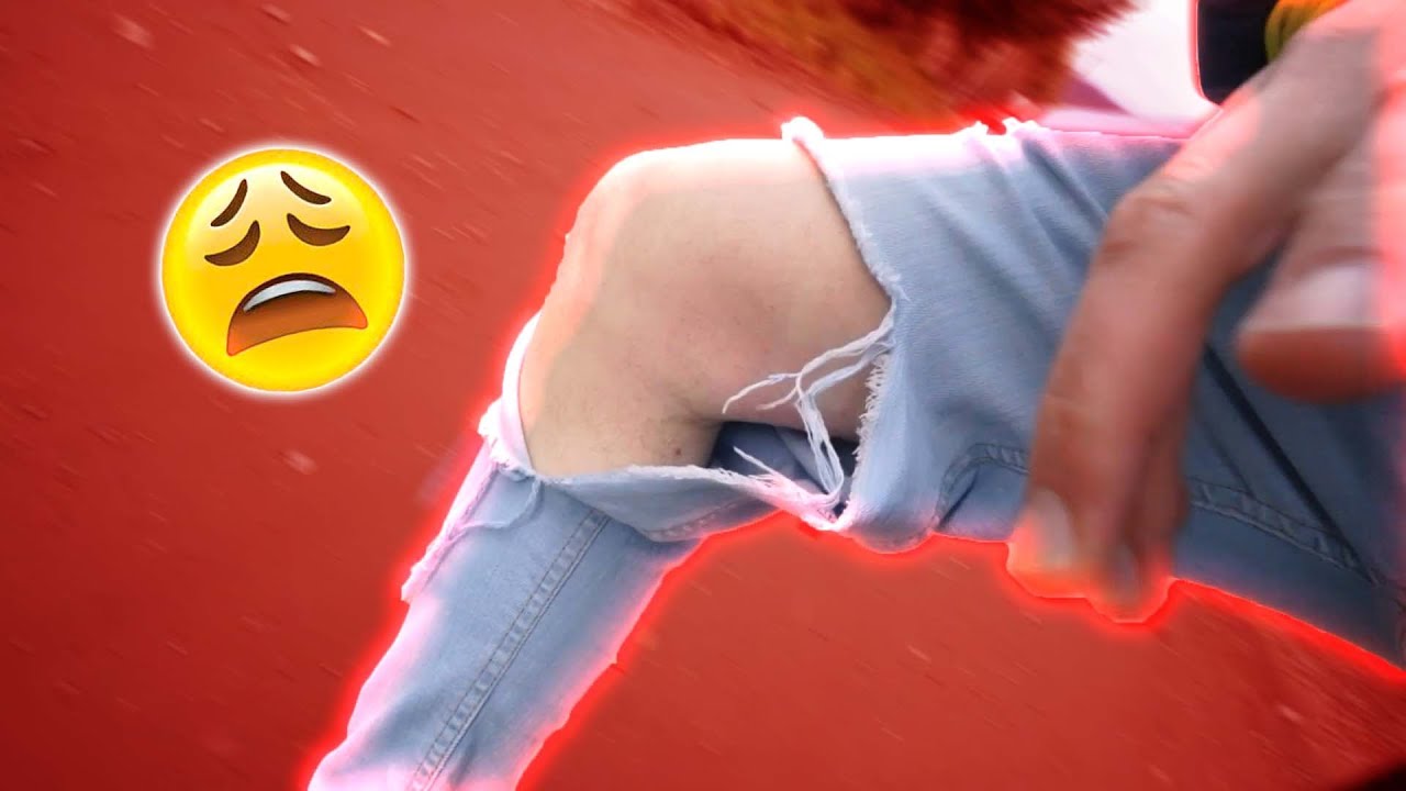 ME MORDIÓ UN PERRO  😱
