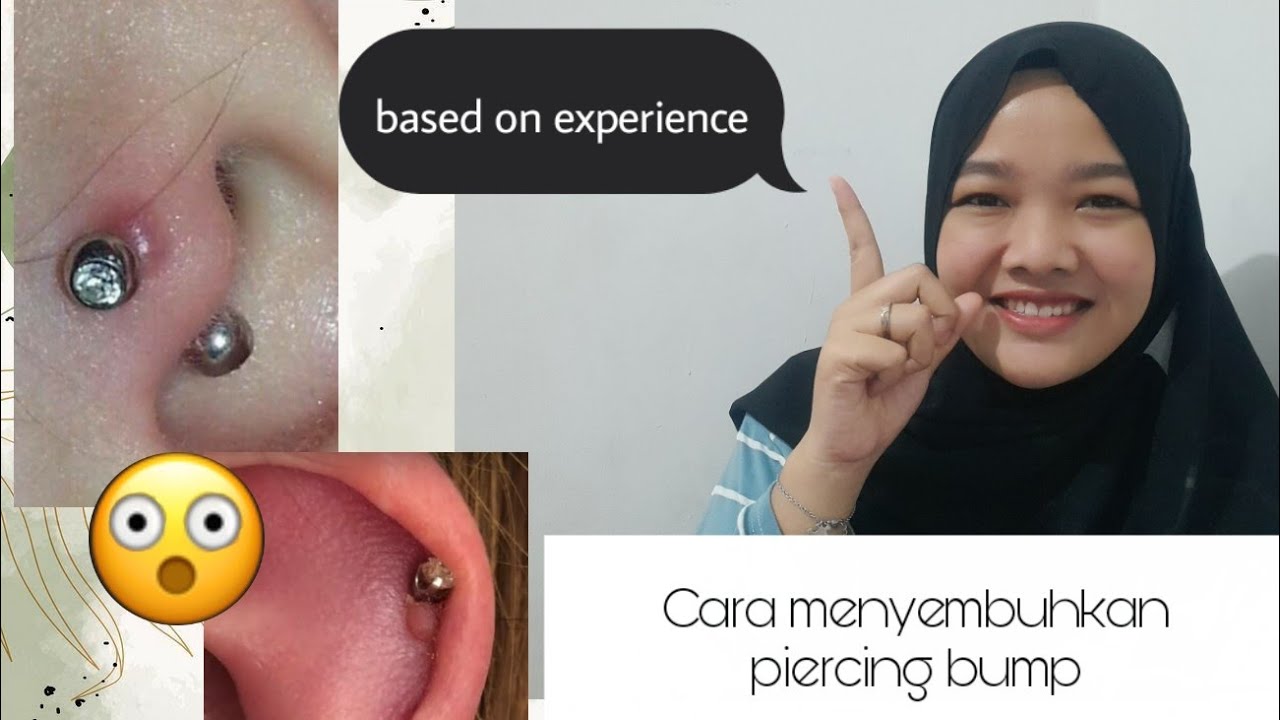 Cara menyembuhkan bengkak pada piercing