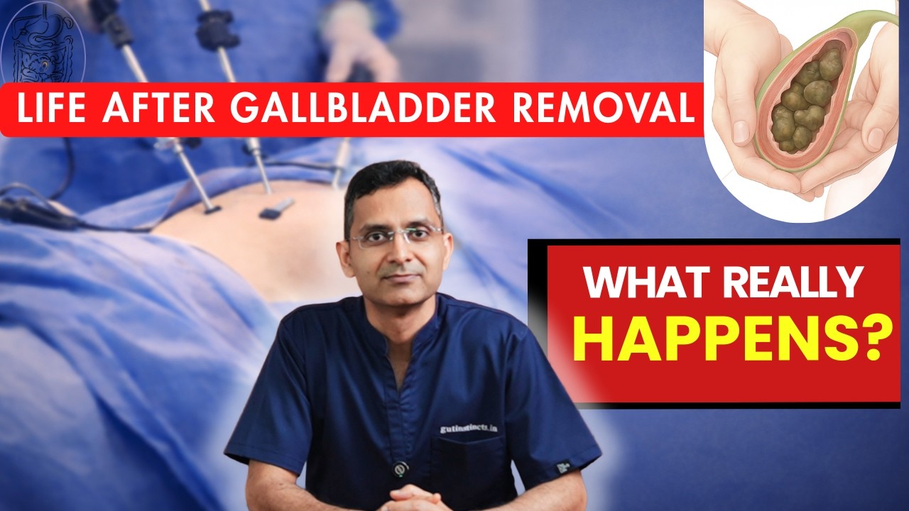 Life After Gallbladder Removal | What Really Happens?