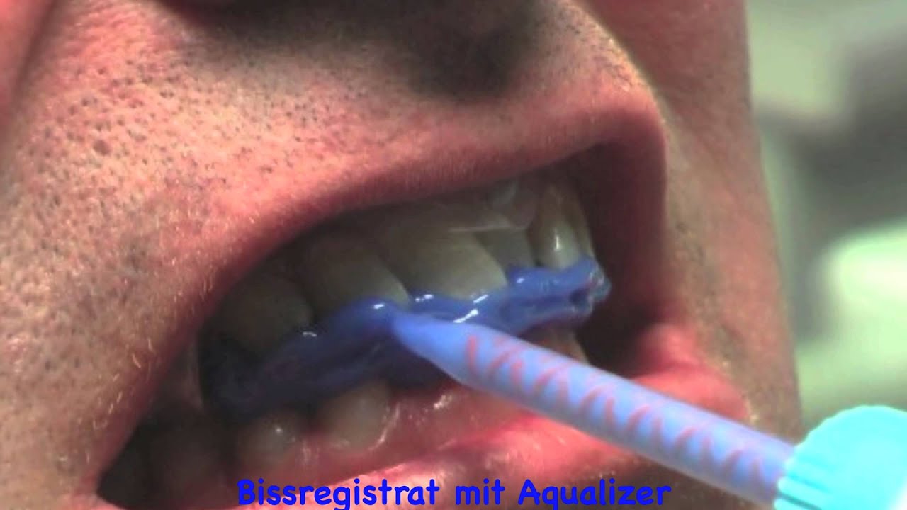 AQUALIZER Biss Registrat ( Аквалайзер, регистрация прикуса)