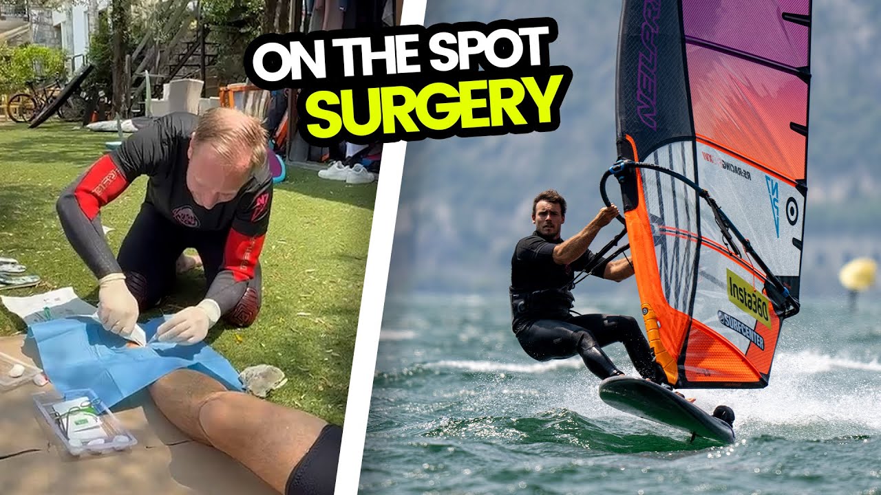 Stitches by the water? Windsurfing Experience Lake Garda | @Nico Prien