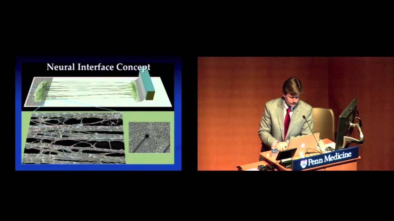 Bionic connections: Interfacing with the nervous system (Dr. Doug Smith)