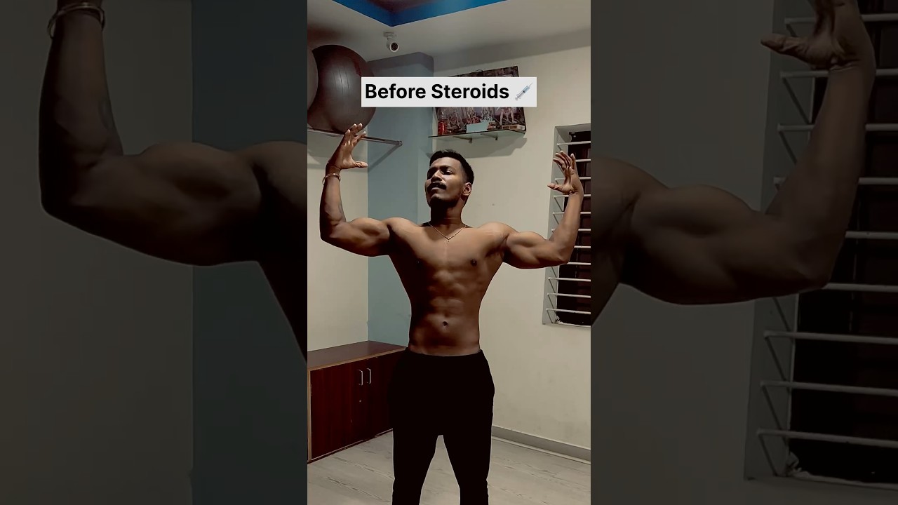 Before and after steroids 💉 #steroid #gym #bodybuilding #bodybuilder #trending #shorts #fitness