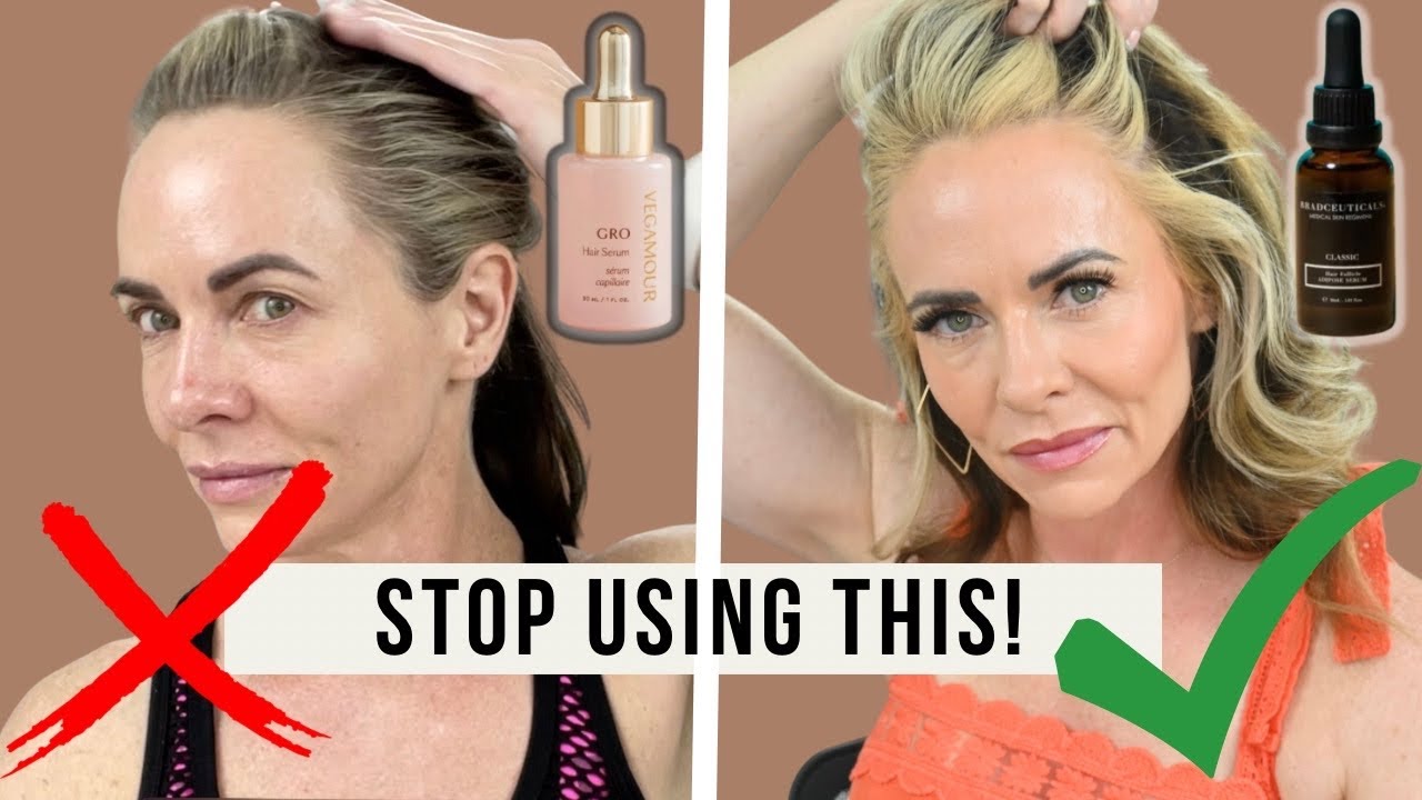 DON’T Use VEGAMOUR GRO Hair Serum for Thinning Hair | Use This Instead
