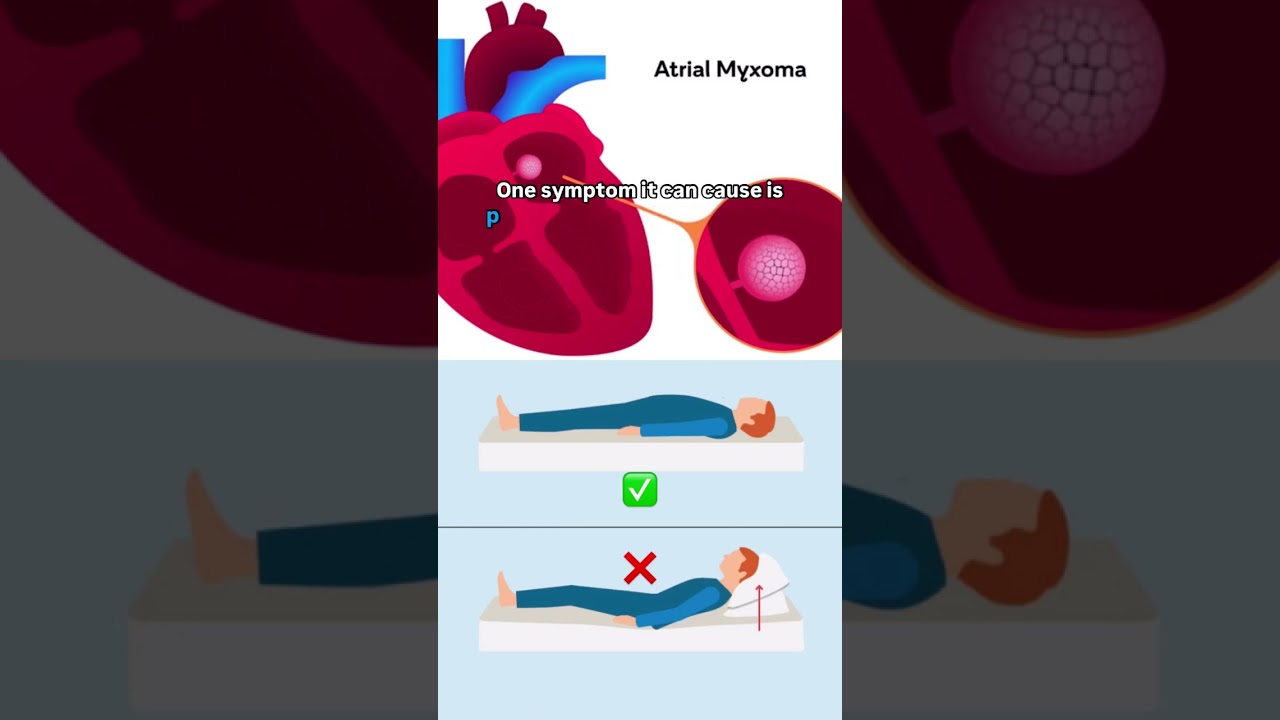 Orthopnea vs Platypnea! #shorts