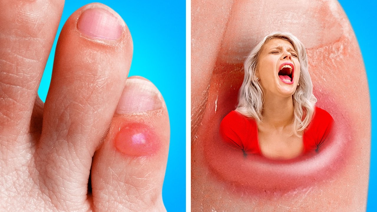 ALL PAIN in ONE VIDEO! If Pain Were People! WEIRD Pranks, DIYs and Hacks