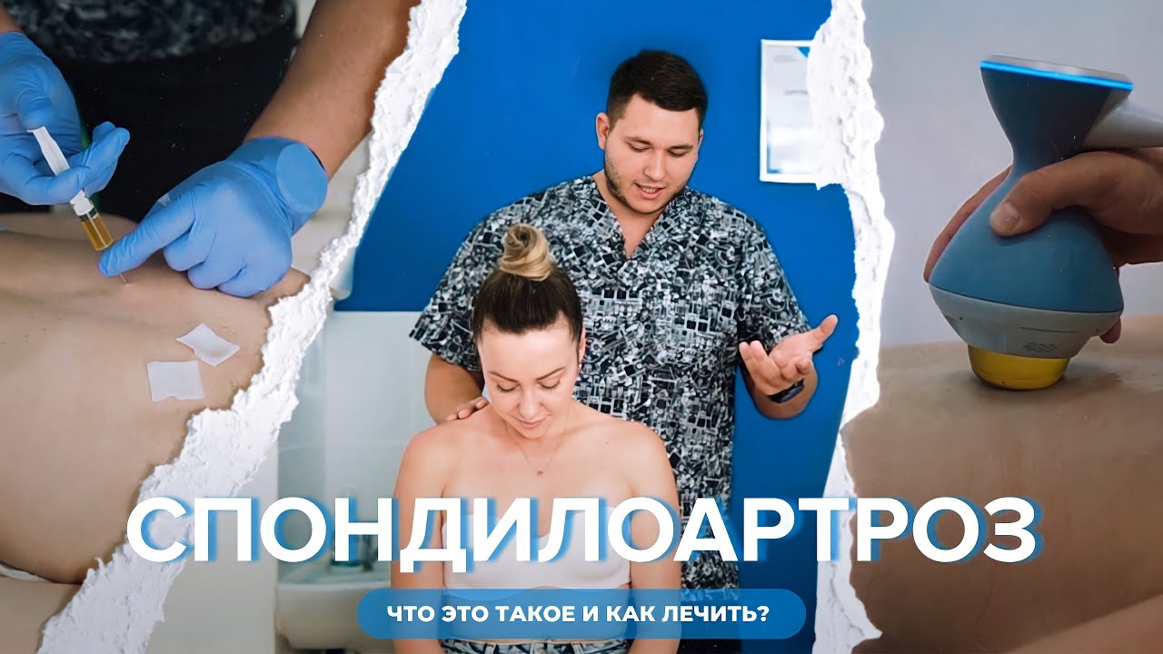 Боли в спине, о которых вы не знали! Или тайны спондилоартроза.