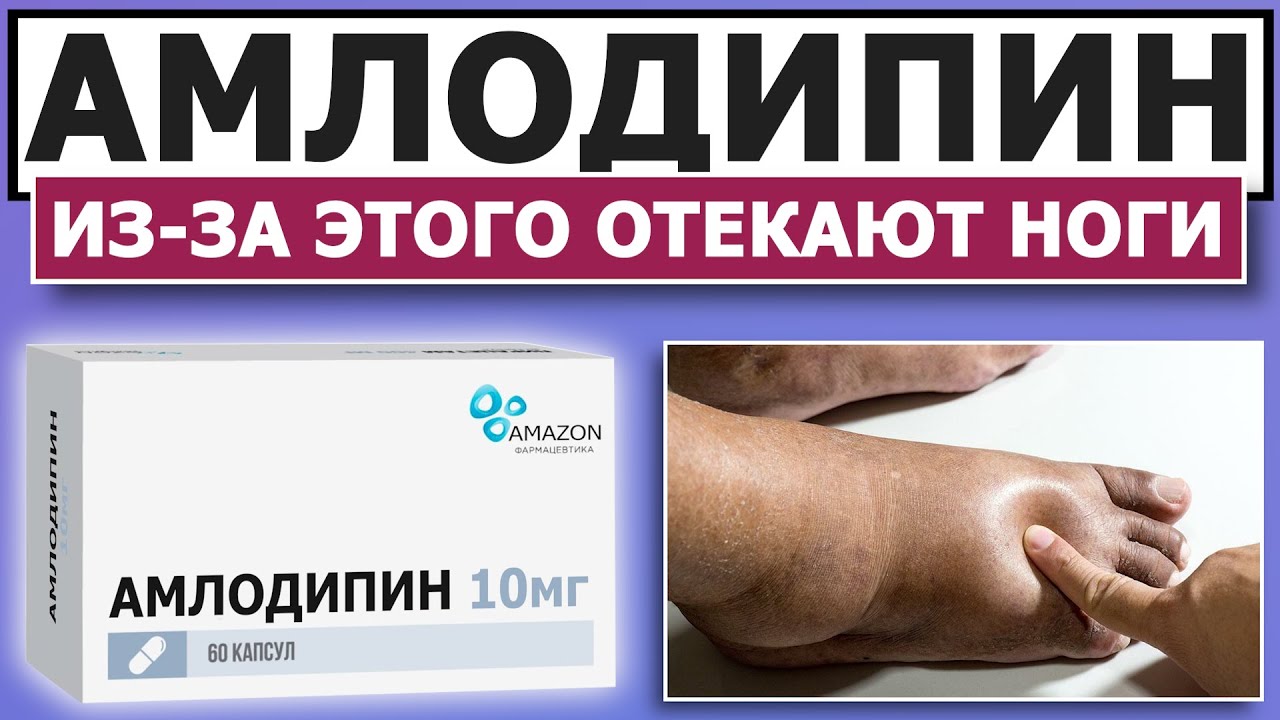 АМЛОДИПИН ⚡ПОЧЕМУ ОТЕКАЮТ НОГИ? КАК УБРАТЬ ОТЁКИ?