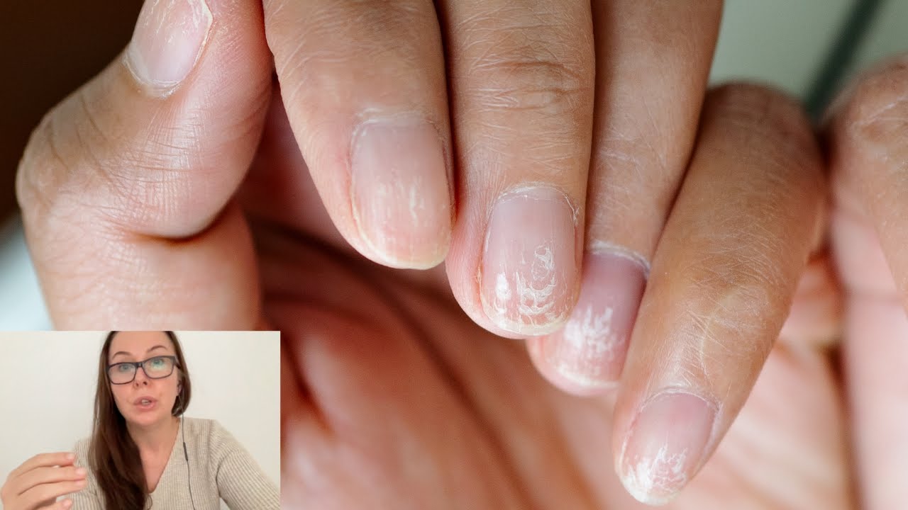 Can you wear gel or acrylic without damaging your nails? [Nail technician explains]