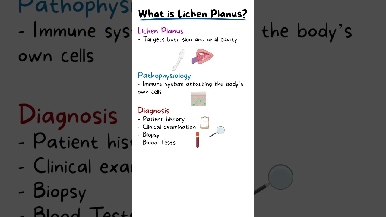 ORAL LICHEN PLANUS EXPLAINED