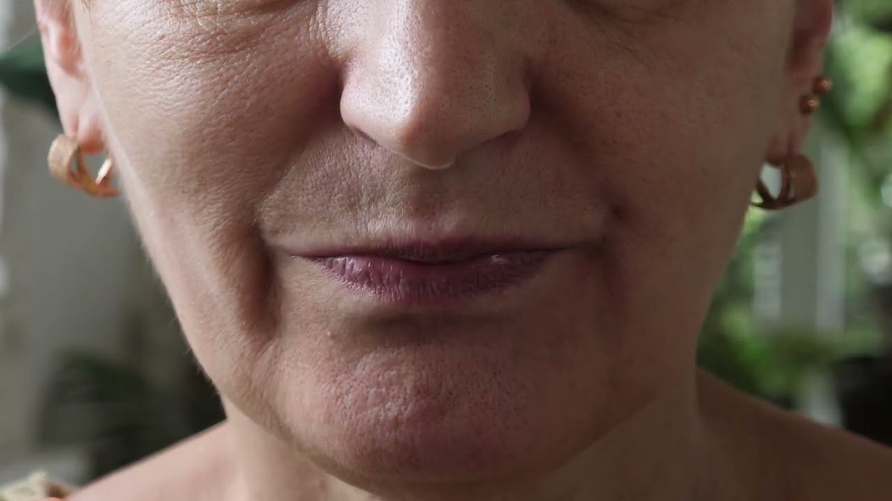 The Many Reasons Why Dentures Are a Thing of the Past