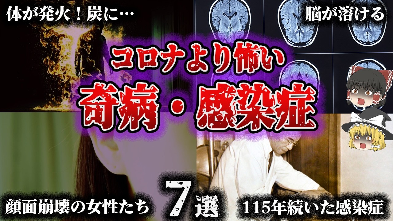 【総集編】感染したら最期…「恐ろしすぎる謎の奇病・感染症7選」【ゆっくり解説】