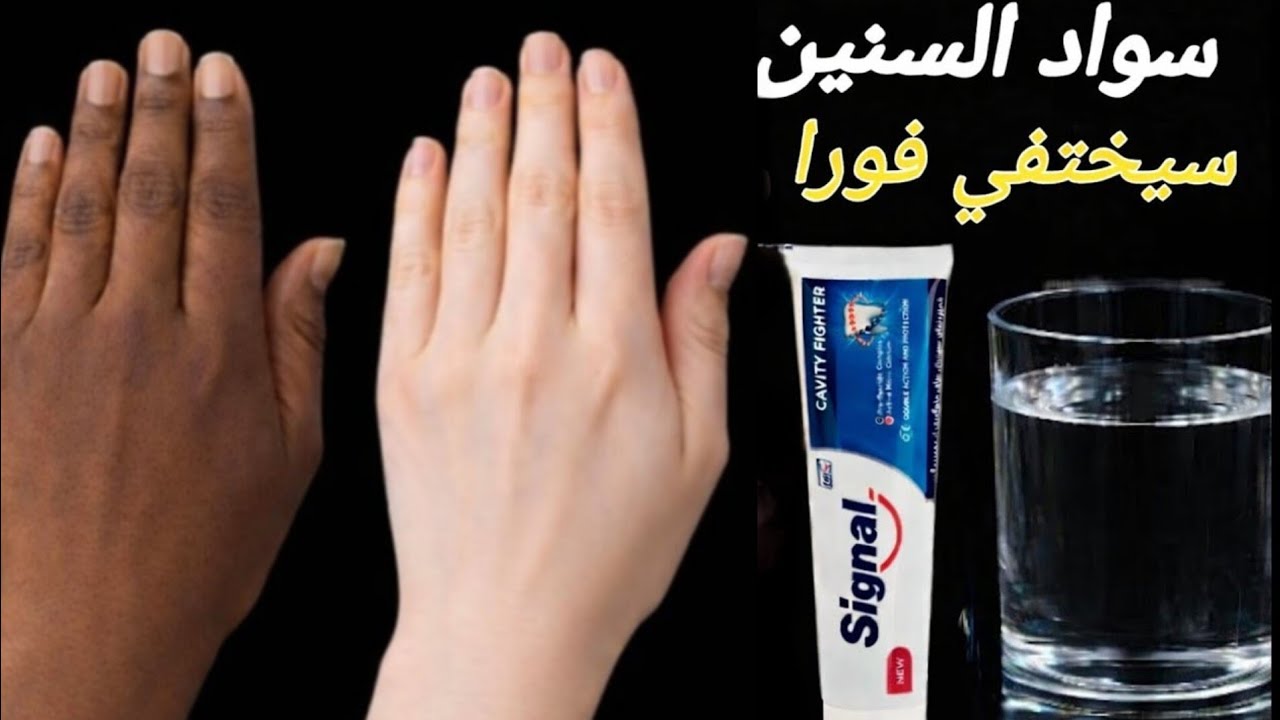 معجون الأسنان والماء‼️تبييض الجسم كامل في دقائق قسما بالله مجربةضعيها علي الوجه سواد سنين سيخرج فورا