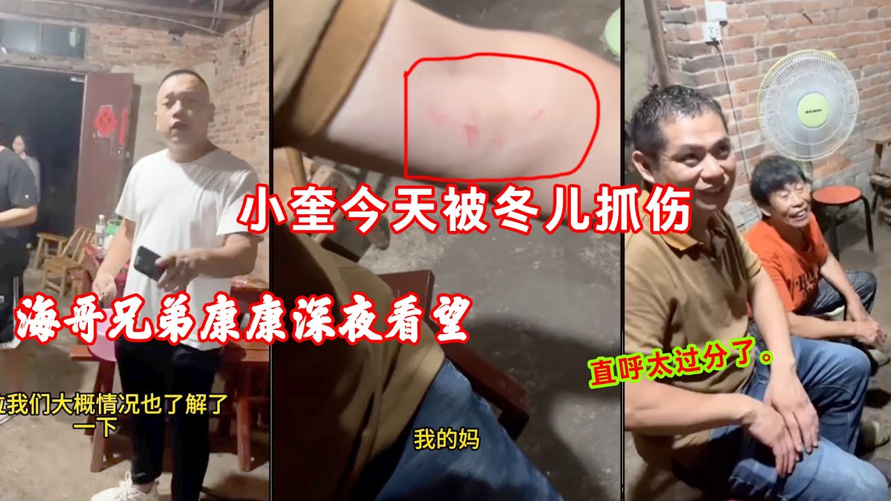 小奎手臂今天被冬儿抓伤，海哥兄弟康康深夜看望，直呼太过分了。