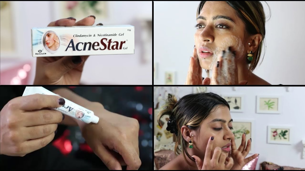 Обзор геля Acnestar — КАК ДЕЙСТВИТЕЛЬНО ИЗБАВИТЬСЯ ОТ АКНЕ | SuperWowStyle Prachi