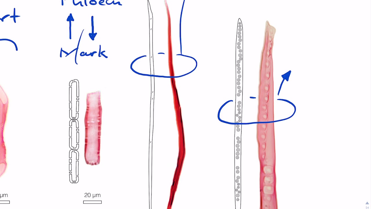 Zelltypen des Xylems