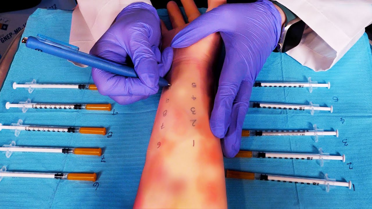 ASMR Hospital Allergy Testing | Severe Allergic Reaction