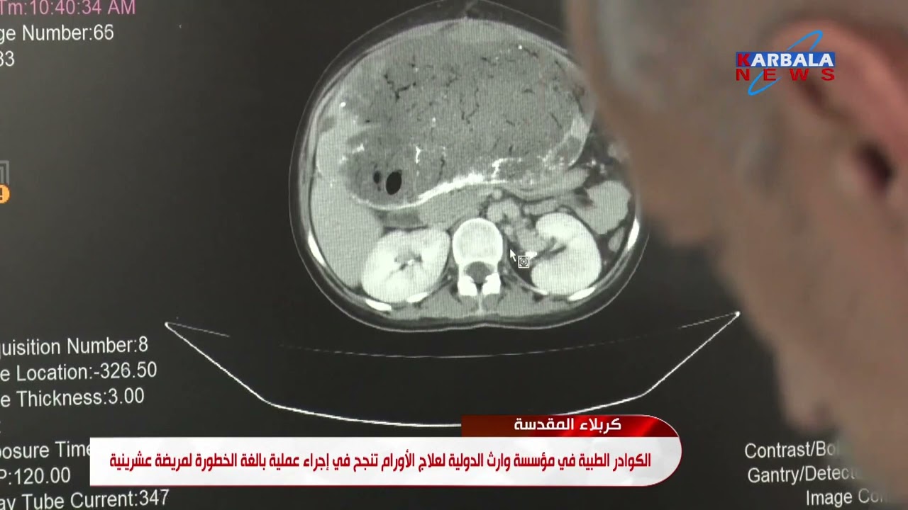 كربلاء المقدسة    الكوادر الطبية في مؤسسة وارث الدولية لعلاج الأورام تنجح في إجراء عملية بالغة الخطو