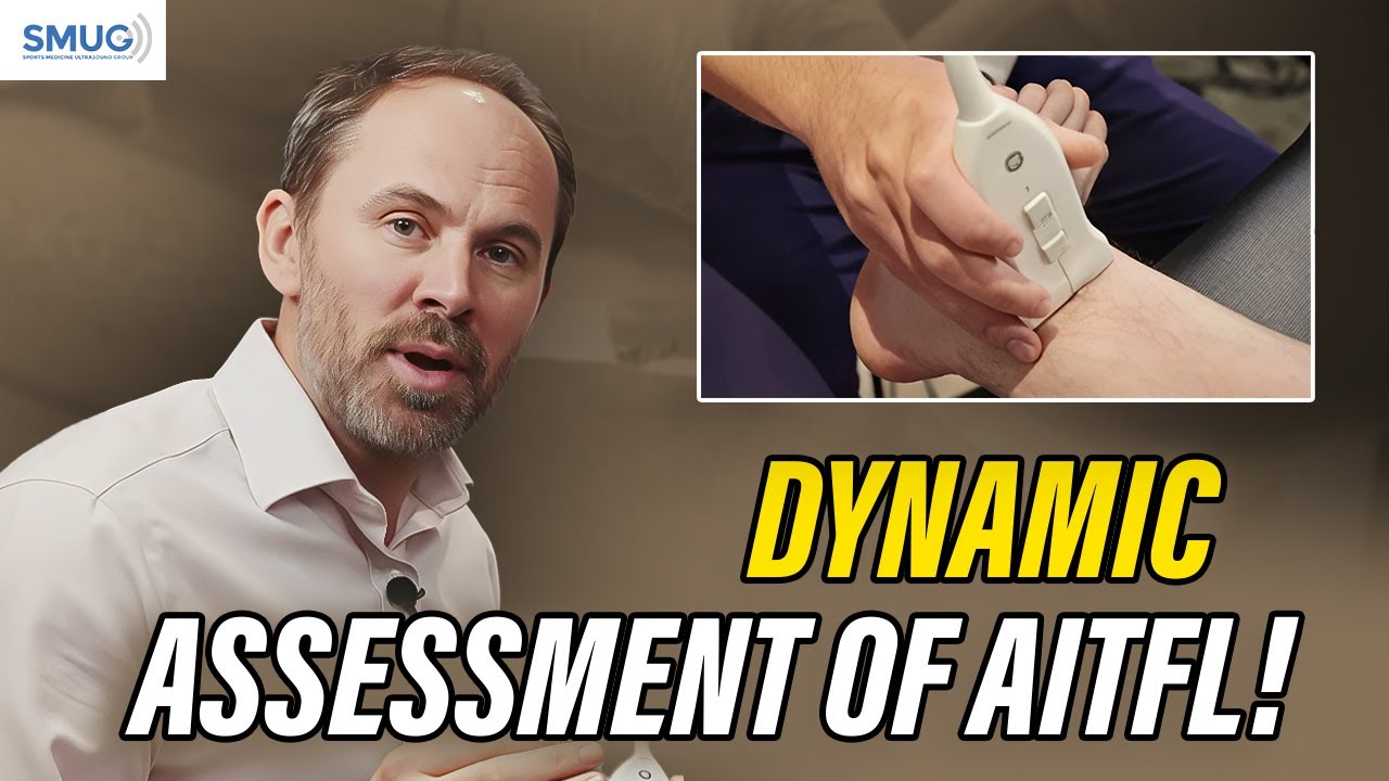 AITFL Ligament Scan | How to Spot Subtle Syndesmosis Instability on Ultrasound