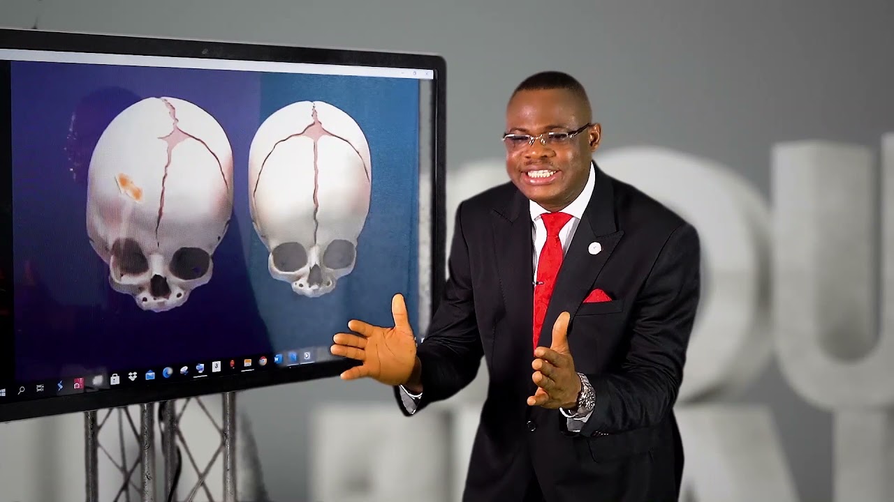STROKE IS NOT A DISEASE