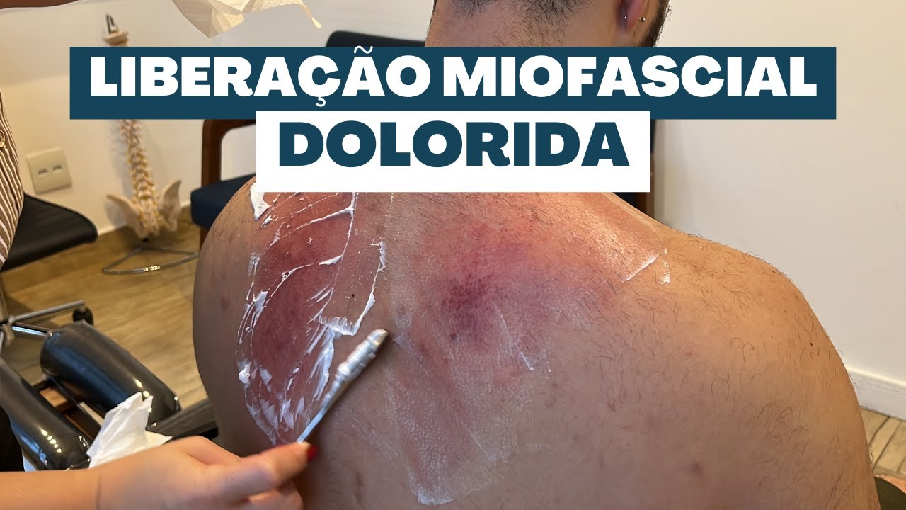 MUITO ESTRALO E LIBERAÇÃO MIOFASCIAL