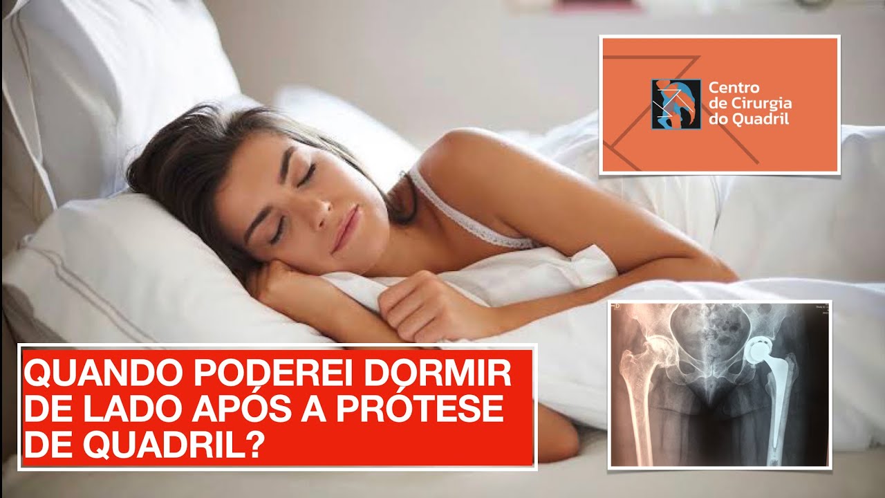 QUANDO PODEREI DORMIR DE LADO APÓS A PRÓTESE DE QUADRIL?