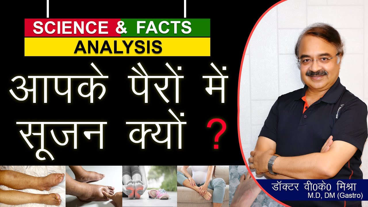 आपके पैरों में सूजन क्यों ? || WHY ARE MY FEET SWOLLEN ?