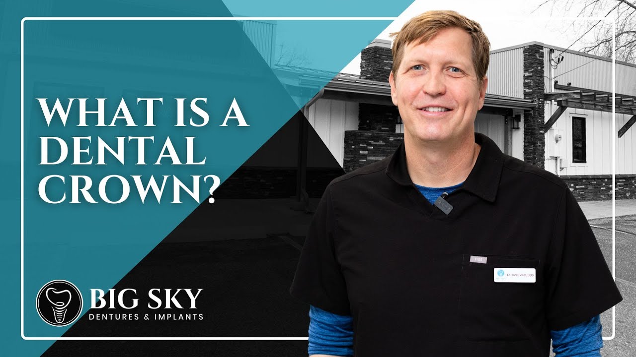 Dental Crowns in Missoula, MT | Big Sky Dentures & Implants